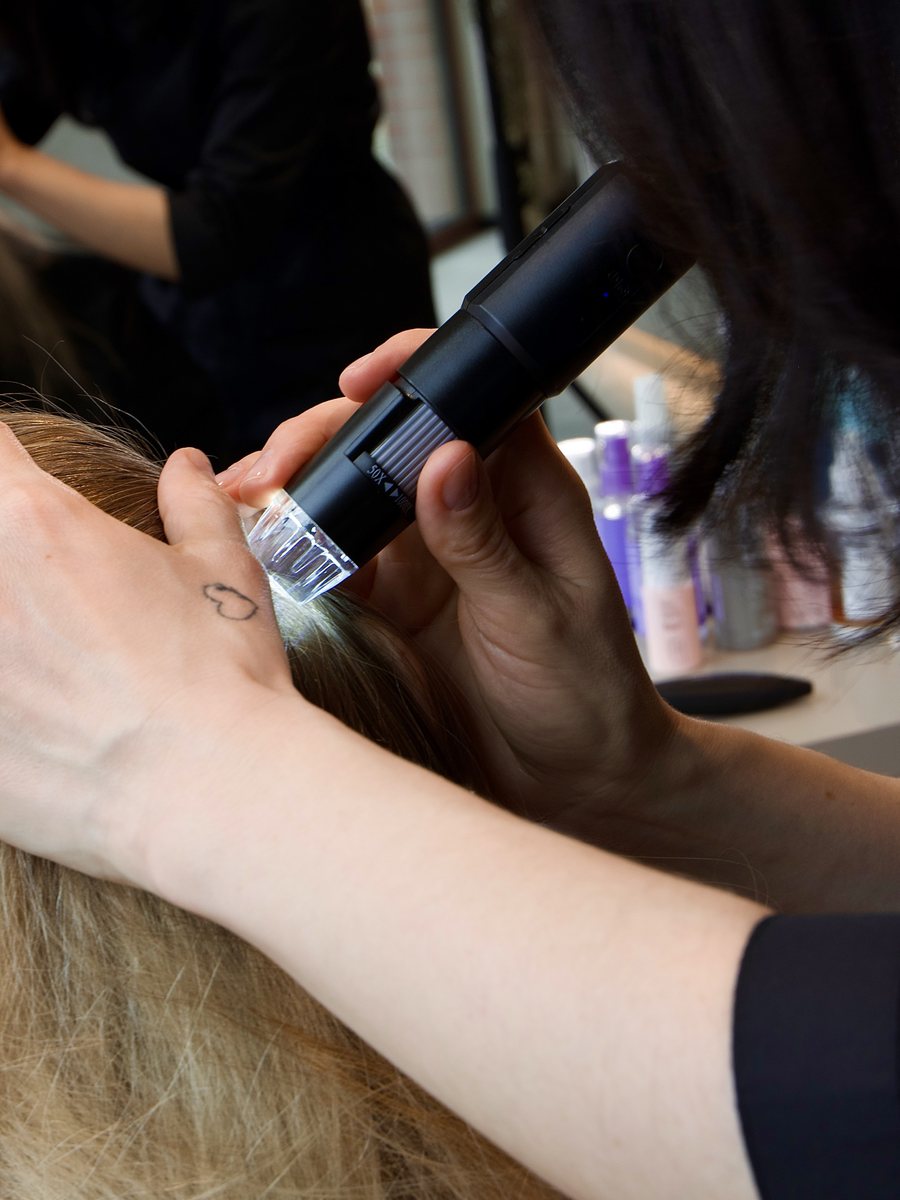 Trichoscopy — scalp diagnostics under the microscope